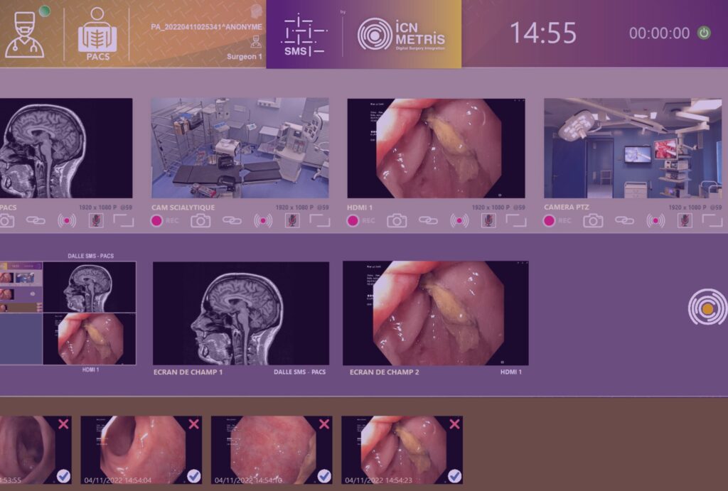 Logiciel de gestion vidéo pour bloc opératoire