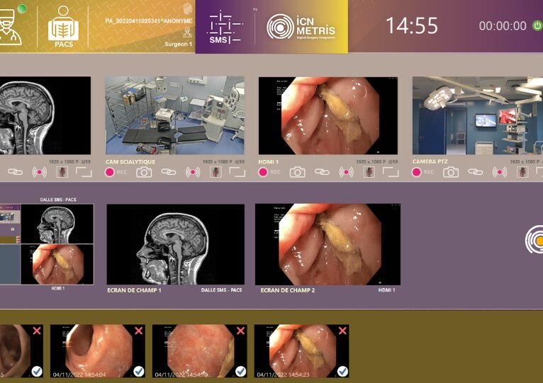 Gérer les images et vidéos du bloc opératoire
