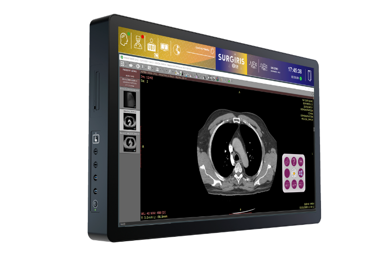 Station DICOM Viewer 55 pouces pour visualisation PACS en bloc opératoire